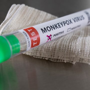 “Moçambique está preparado para fazer diagnóstico e tratamento da varíola dos macacos”
