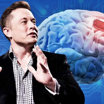 Elon Musk: Primeiro ser humano com implantes cerebrais será dotado ainda este ano