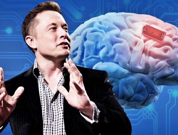 Elon Musk: Primeiro ser humano com implantes cerebrais será dotado ainda este ano