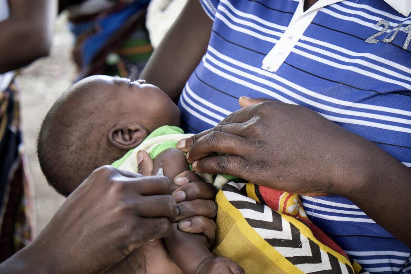 Surto de sarampo volta a eclodir no centro de Moçambique com 145 casos já registados
